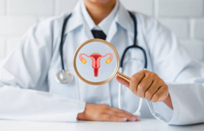 PCOS Management Write for Us