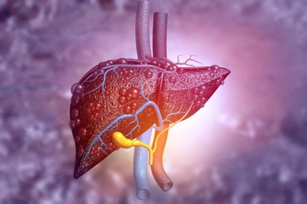 Fatty Liver Disease