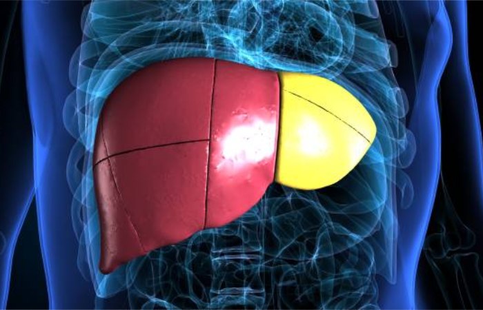 Treatment for Fatty Liver_ Can It Be Reversed