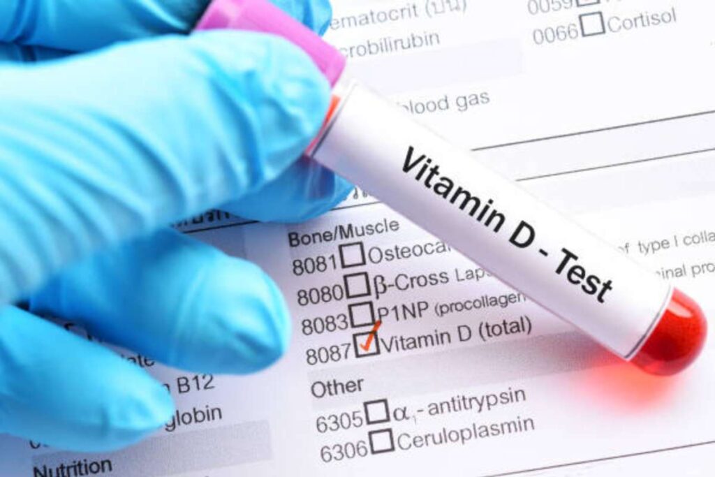 Vitamin D Test